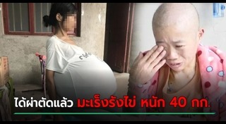 มะเร็งรังไข่