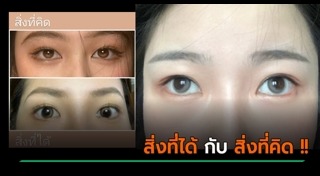 คอนแทคเลนส์