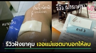 คุมกำเนิด