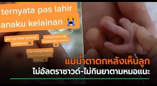 อัลตราซาวด์