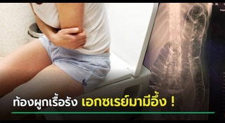 ท้องผูกเรื้อรัง