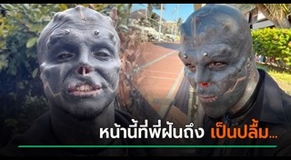 ศัลยกรรมแปลกๆ