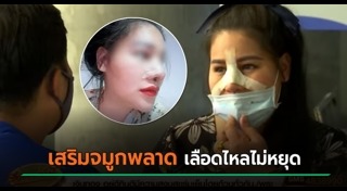 ศัลยกรรมหน้าพัง