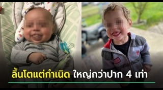 เด็กพิการ