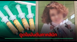 ดูดไขมัน