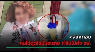 ดูดไขมัน