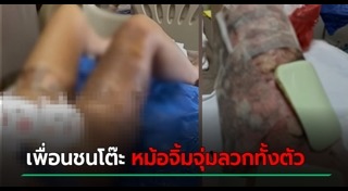 น้ำร้อนลวก