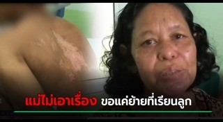 แผลพุพอง