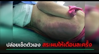 บ้านพักคนชรา