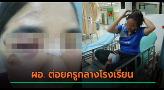 ต่อยผู้หญิง