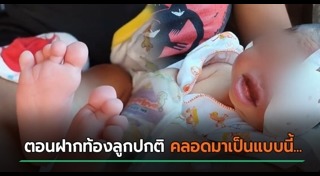 เด็กพิการ