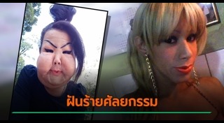 ศัลยกรรมหน้าพัง