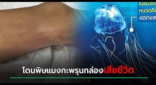 แมงกะพรุนกล่อง