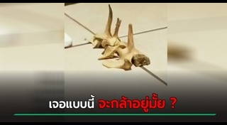 โครงกระดูก