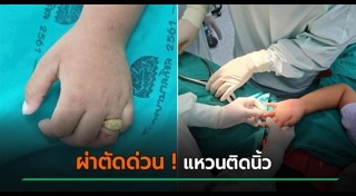 แหวนทอง