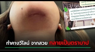 ศัลยกรรมหน้าพัง