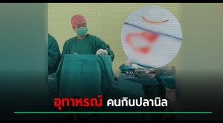 ก้างปลาติดคอ