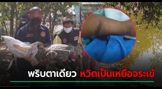 จระเข้กัดคน