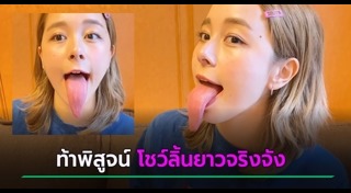 หัวเข่า