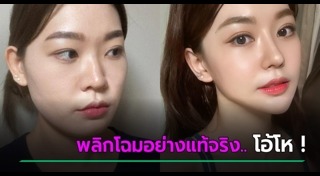 ศัลยกรรมเกาหลี