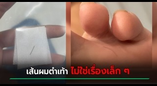 ผมหนา