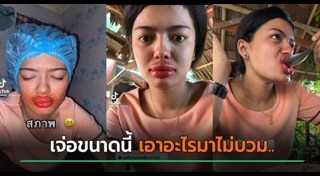 ศัลยกรรมปาก