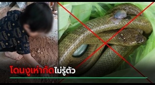 เด็กถูกงูกัด