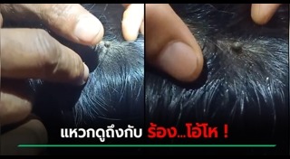 เห็บหมัด