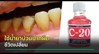 น้ำยาบ้วนปาก