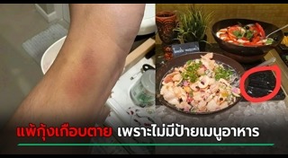 แพ้อาหาร