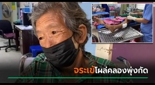 จระเข้กัดคน