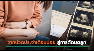 ปวดประจำเดือน