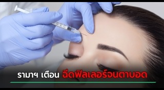 ฉีดฟิลเลอร์