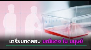 ชะลอความแก่