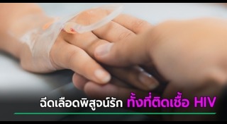 เชื้อ HIV