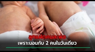ลูกแฝด