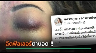 ศัลยกรรมทำพิษ