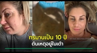 ศัลยกรรมทำพิษ