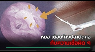 ก้างปลาติดคอ