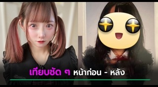 ศัลยกรรมตา