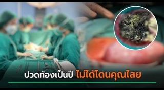 เนื้องอก