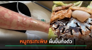 สารพิษปนเปื้อน