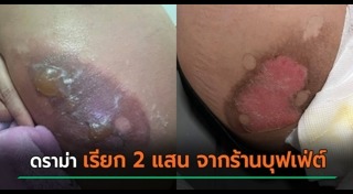 แผลพุพอง