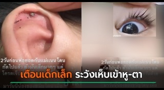 เห็บหมัด