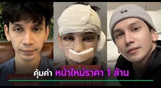 ศัลยกรรมเกาหลี