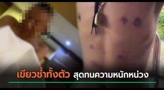 ทารุณกรรมทางเพศ