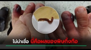 กิ้งกือ