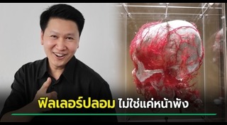 ฉีดฟิลเลอร์