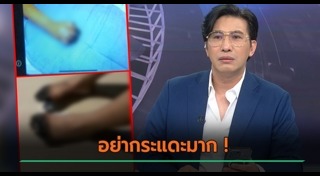 ติดเชื้อในกระแสเลือด