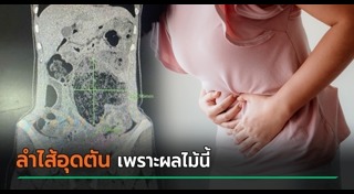 ลำไส้